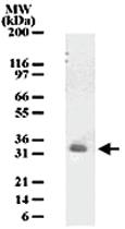 Anti-PGLYRP3 Mouse Monoclonal Antibody [clone: 187C434]