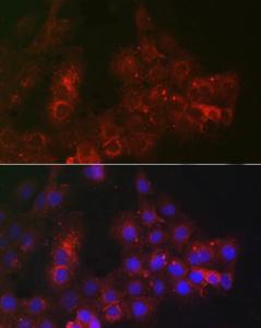 Anti-TROP2 antibody