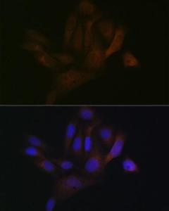 Immunofluorescence analysis of U-2 OS cells using Anti-BAP31 Antibody [ARC1894] (A308503) at a dilution of 1:100 (40X lens). DAPI was used to stain the cell nuclei (blue)