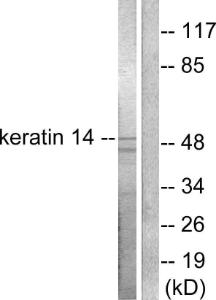 Western blot analysis of lysates from NIH/3T3 cells using Anti-Keratin 14 Antibody The right hand lane represents a negative control, where the antibody is blocked by the immunising peptide