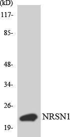 Western blot analysis of the lysates from HepG2 cells using Anti-BCA3 Antibody