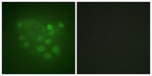 Immunofluorescence analysis of A549 cells using Anti-KIF2C Antibody The right hand panel represents a negative control, where the antibody was pre-incubated with the immunising peptide