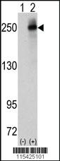 Anti-ALK Rabbit Polyclonal Antibody