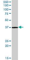 Anti-CRELD2 Mouse Polyclonal Antibody