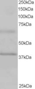 EB05200 staining (1µg/ml) of Human Heart lysate (RIPA buffer, 35µg total protein per lane).  Primary incubated for 1 hour.  Detected by western blot using chemiluminescence.