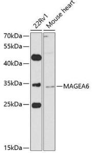 Western blot analysis of extracts of various cell lines, using Anti-MAGEA6 Antibody (A10308) at 1:1,000 dilution. The secondary antibody was Goat Anti-Rabbit IgG H&L Antibody (HRP) at 1:10,000 dilution.