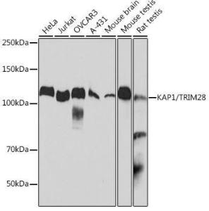 Western blot analysis of extracts of various cell lines, using Anti-KAP1 Antibody [ARC0047] (A308504) at 1:1,000 dilution. The secondary antibody was Goat Anti-Rabbit IgG H&L Antibody (HRP) at 1:10,000 dilution.