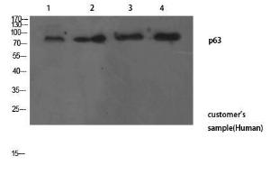 Antibody anti-TP63 100 µg