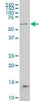 Anti-NCOA4 Mouse Monoclonal Antibody [clone: 1E5]