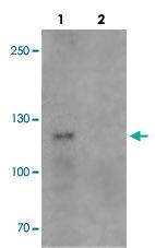 Anti-TCIRG1 Rabbit Polyclonal Antibody