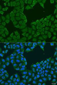 Immunofluorescence analysis of U2OS cells using Anti-MAGEA6 Antibody (A10308) at a dilution of 1:100. DAPI was used to stain the cell nuclei (blue).