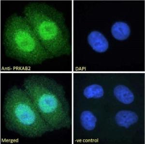 Anti-PRKAB2 Antibody (A121178) - Immunofluorescence analysis of paraformaldehyde fixed MCF7 cells, permeabilized with 0.15% Triton