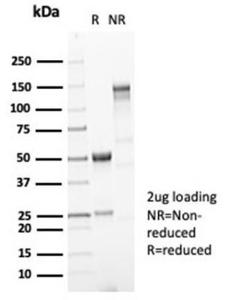 SDS-PAGE analysis of Anti-Mucin 5AC Antibody [MUC5AC/7067R] under non-reduced and reduced conditions; showing intact IgG and intact heavy and light chains, respectively. SDS-PAGE analysis confirms the integrity and purity of the antibody