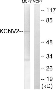 Anti-KCNV2 Rabbit Polyclonal Antibody