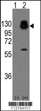 Anti-H Cadherin (CDH13) Rabbit Polyclonal Antibody