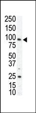 Anti-AXL Rabbit Polyclonal Antibody