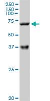 Anti-CPT2 Rabbit Polyclonal Antibody