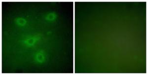 Immunofluorescence analysis of NIH/3T3 cells using Anti-Keratin 14 Antibody The right hand panel represents a negative control, where the antibody was pre-incubated with the immunising peptide