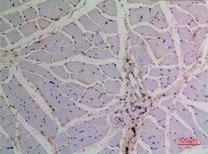 Antibody anti-TP63 100 µg