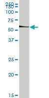 Anti-ETS1 Rabbit Polyclonal Antibody