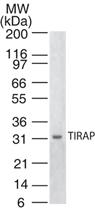 Anti-TIRAP Mouse Monoclonal Antibody [clone: 20D1960.2.1]