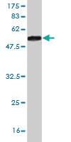 Anti-SALL2 Mouse Monoclonal Antibody [clone: 3F7]