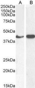 Anti-alpha smooth muscle actin antibody