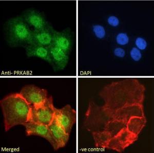 Anti-PRKAB2 Antibody (A121178) - Immunofluorescence analysis of paraformaldehyde fixed A431 cells, permeabilized with 0.15% Triton