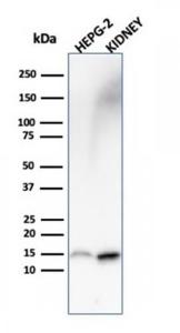 Antibody anti-FABP1 FABP13487 100 µg