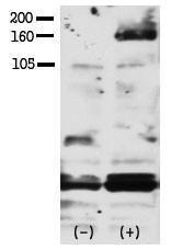 Anti-ERBB4 Rabbit Polyclonal Antibody (PE (Phycoerythrin))