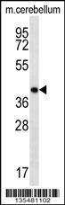 Anti-HOXD13 Rabbit Polyclonal Antibody (AP (Alkaline Phosphatase))