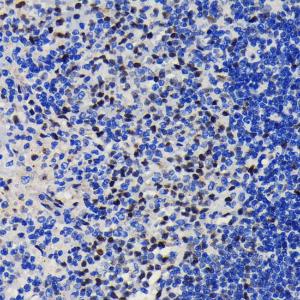 Immunohistochemistry analysis of paraffin-embedded rat spleen using Anti-KAP1 Antibody [ARC0047] (A308504) at a dilution of 1:100 (40x lens). Perform microwave antigen retrieval with 10 mM PBS buffer pH 7.2 before commencing with IHC staining protocol.