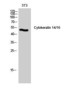 Western blot analysis of 3T3 cells using Anti-Keratin 14 Antibody