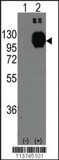 Anti-H Cadherin (CDH13) Rabbit Polyclonal Antibody