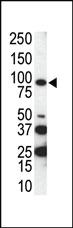 Anti-AXL Rabbit Polyclonal Antibody