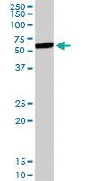 Anti-ETS1 Rabbit Polyclonal Antibody