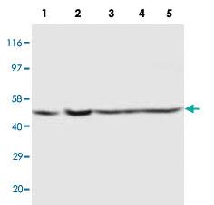 Anti-PSEN2 Rabbit Polyclonal Antibody