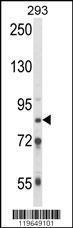 Anti-TARSL2 Rabbit Polyclonal Antibody (AP (Alkaline Phosphatase))