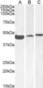 Anti-alpha smooth muscle actin antibody