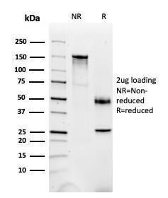 Antibody anti-FABP1 FABP13487 100 µg