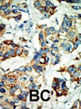 Anti-NEK4 Rabbit Polyclonal Antibody (Biotin)