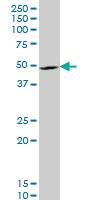 Anti-LHX4 Mouse Monoclonal Antibody [clone: 2B12]