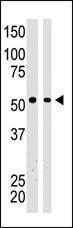 Anti-BAIAP2 Rabbit Polyclonal Antibody (FITC (Fluorescein))