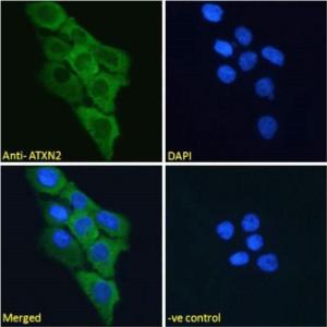 Anti-ATXN2 Antibody (A121157) - Immunofluorescence analysis of paraformaldehyde fixed A431 cells, permeabilized with 0.15% Triton. Primary incubation 1hr (10µg/ml) followed by Alexa Fluor 488 secondary antibody (2µg/ml), showing cytoplasmic staining.