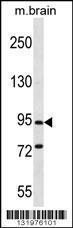 Anti-PCDHGC5 Rabbit Polyclonal Antibody (AP (Alkaline Phosphatase))