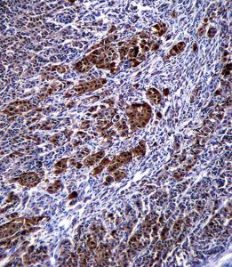 Anti-S100B Rabbit Polyclonal Antibody