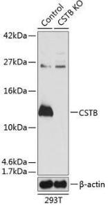 Western blot analysis of extracts from normal (control) and CSTB knockout (KO) 293T cells, using Anti-Cystatin-B Antibody (A307533) at 1:1000 dilution. The secondary Antibody was Goat Anti-Rabbit IgG H&L Antibody (HRP) at 1:10000 dilution