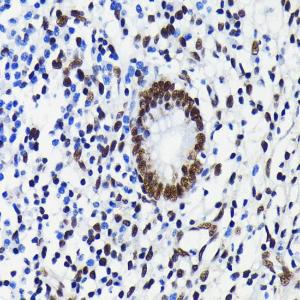 Immunohistochemistry analysis of paraffin-embedded human appendix tissue using Anti-KAP1 Antibody [ARC0047] (A308504) at a dilution of 1:100 (40x lens). Perform microwave antigen retrieval with 10 mM PBS buffer pH 7.2 before commencing with IHC staining protocol.