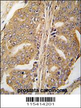 Anti-PXN Rabbit Polyclonal Antibody