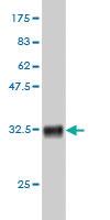 Anti-CDG1H Mouse Monoclonal Antibody [clone: 2E10]